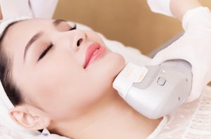 Công nghệ nâng cơ mặt là gì?